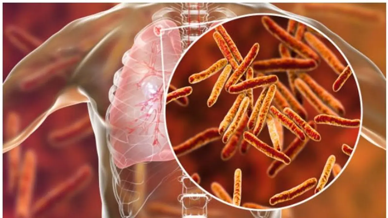 World Tuberculosis Day 2022 : ലോക ക്ഷയരോഗദിനം; ഈ ദിനത്തിന്റെ പ്രധാന്യത്തെ കുറിച്ചറിയാം
