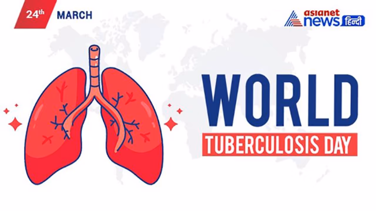 World TB Day 2022: क्या होता है DOTS? जानें सबसे घातक संक्रमण से बचने का तरीका World TB Day 2022: क्या होता है DOTS? जानें सबसे घातक संक्रमण से बचने का तरीका