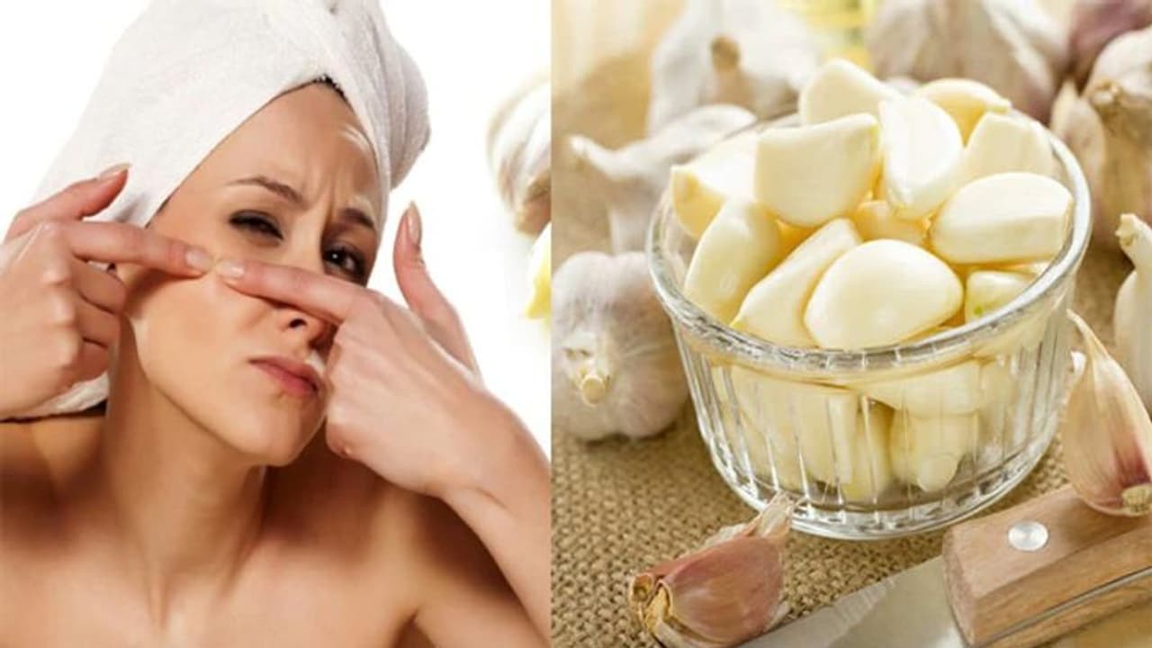 Beauty Tips: அழகான முகத்தில் ஆங்காங்கே கரும்புள்ளிகள்; கவலையை விடுங்க; சிம்பிள் பியூட்டி டிப்ஸ் இதோ!!