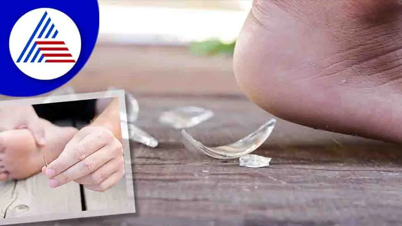 ಮುಳ್ಳು ಅಥವಾ ಗಾಜಿನ ಪೀಸ್ ಚುಚ್ಚಿದ್ರೆ ಚಿಕಿತ್ಸೆ ಏನ್ಮಾಡ್ಬೇಕು?