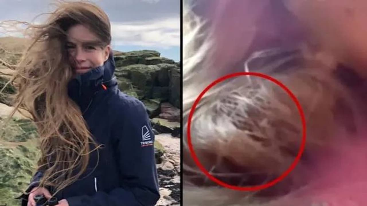 യുവതിയുടെ മുടിയിൽ കൂടുകെട്ടിയ പക്ഷിക്കുഞ്ഞ്!