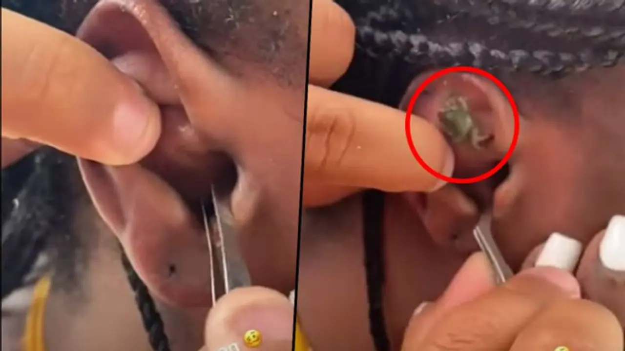Crab gets stuck inside woman’s ear while snorkelling; find out what happens next Crab gets stuck inside woman’s ear while snorkelling; find out what happens next