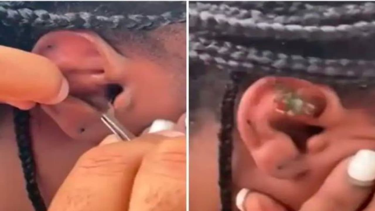 महिला के कान को घर समझकर अंदर घुस गया केकड़ा, वायरल वीडियो में देखिए आगे क्या हुआ 