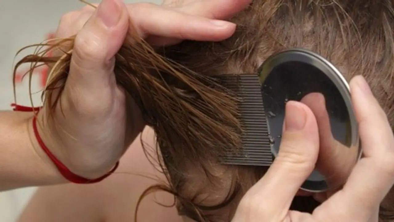 ১ দিনে মাথার উঁকুন দূর করুন, ৩টি সেরা পদ্ধতি, কোনটা কতটা নির্ভরযোগ্য ১ দিনে মাথার উঁকুন দূর করুন, ৩টি সেরা পদ্ধতি, কোনটা কতটা নির্ভরযোগ্য