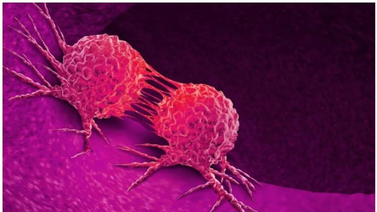 Cancer : ഇന്ത്യക്കാർക്കിടയിൽ ഈ ക്യാൻസർ ബാധിക്കുന്നവരുടെ എണ്ണം കൂടി വരുന്നതായി വിദഗ്ധർ Cancer : ഇന്ത്യക്കാർക്കിടയിൽ ഈ ക്യാൻസർ ബാധിക്കുന്നവരുടെ എണ്ണം കൂടി വരുന്നതായി വിദഗ്ധർ