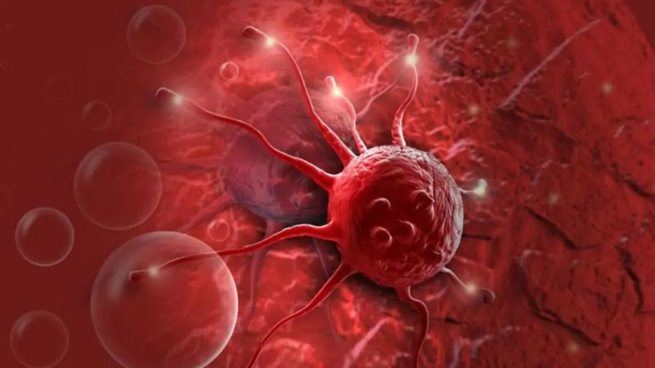 Cancer : വ്യായാമം ചെയ്യുന്നത് ഈ അർബുദം പിടിപെടാനുള്ള സാധ്യത കുറയ്ക്കുന്നു; പഠനം