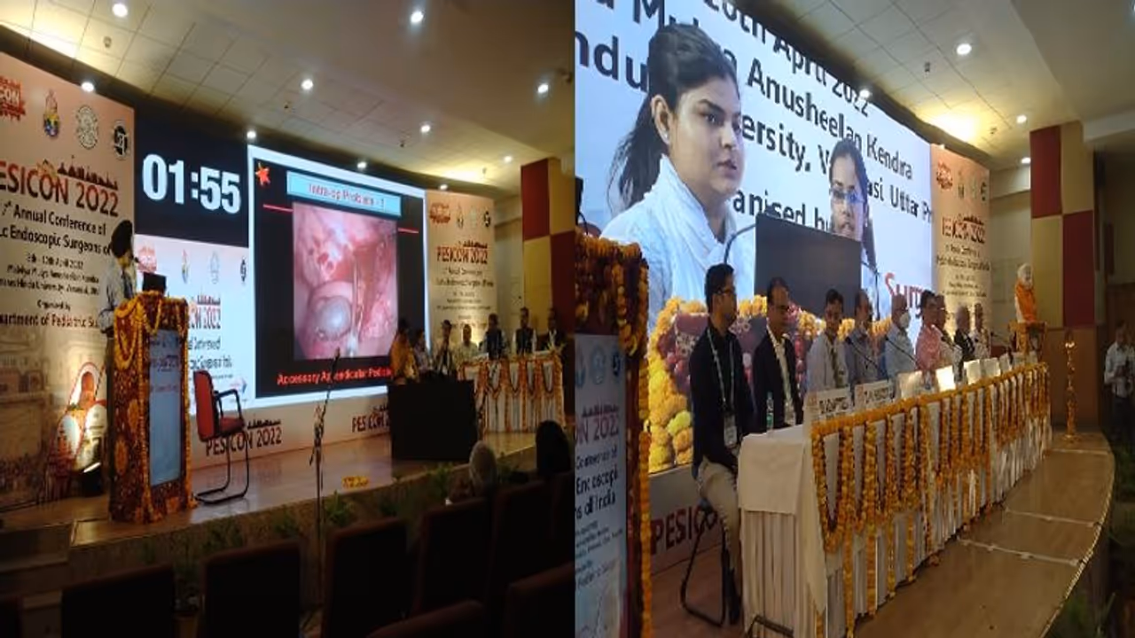 BHU में शल्य चिकित्सा का 17वां राष्ट्रीय अधिवेशन की हुई शुरुआत, डॉक्टर्स ने दी दूरबीन से ऑपरेशन की जानकारी