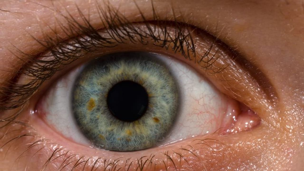 Eye Health: ಕಣ್ಣುಗಳಲ್ಲಿ ಉಂಟಾಗುವ ಈ ಲಕ್ಷಣಗಳನ್ನು ಅಲಕ್ಷಿಸಬೇಡಿ