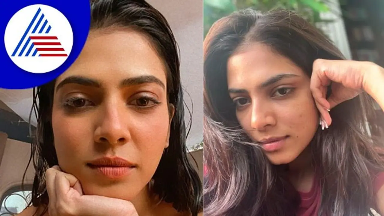 ನಟಿಯರ ತ್ವಚೆ wow ಅಂದುಕೊಳ್ಳಬೇಡಿ; ಮೊಡವೆ ಮುಖದ ಫೋಟೋ ಹಂಚಿಕೊಂಡ ನಟಿ ಮಾಳವಿಕಾ!