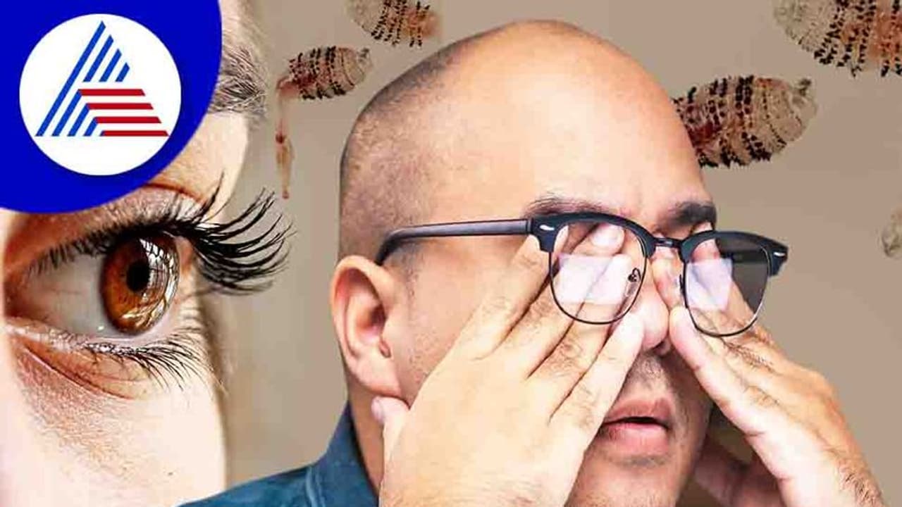 ವ್ಯಕ್ತಿಯ ಕಣ್ಣಿನೊಳಗಿತ್ತು ಒಂದು ಡಜನ್ಗೂ ಹೆಚ್ಚು ನೊಣಗಳ ಮೊಟ್ಟೆ ! ವ್ಯಕ್ತಿಯ ಕಣ್ಣಿನೊಳಗಿತ್ತು ಒಂದು ಡಜನ್ಗೂ ಹೆಚ್ಚು ನೊಣಗಳ ಮೊಟ್ಟೆ !