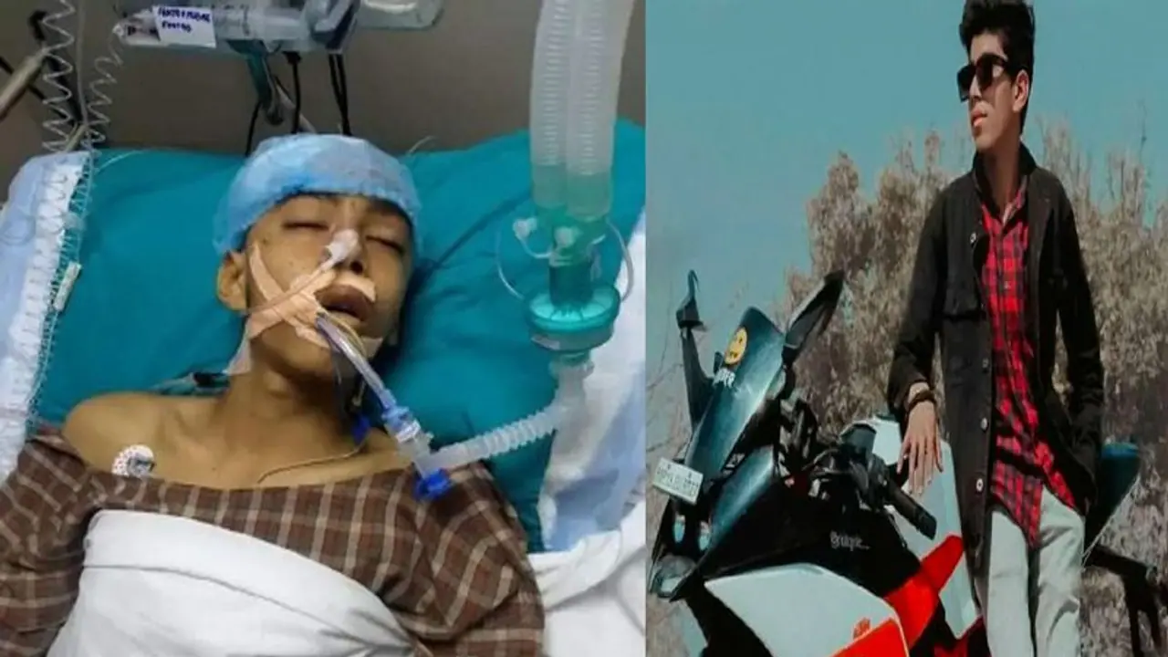 खरगोन हिंसा का जख्म: तीन दिन बाद जिस बहन की थी शादी उसका भाई वेंटिलेटर पर, बोल भी नहीं पा रहा, बस आंसू गिर रहे