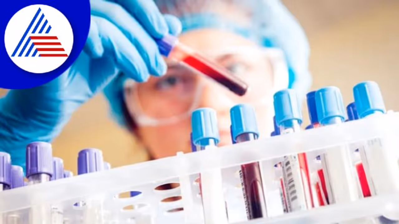 ಬ್ಲಡ್ ಟೆಸ್ಟ್ ಮಾಡಿಸೋ ಮೊದಲು ಈ ವಿಚಾರಗಳನ್ನು ತಿಳಿದುಕೊಳ್ಳಿ ಬ್ಲಡ್ ಟೆಸ್ಟ್ ಮಾಡಿಸೋ ಮೊದಲು ಈ ವಿಚಾರಗಳನ್ನು ತಿಳಿದುಕೊಳ್ಳಿ