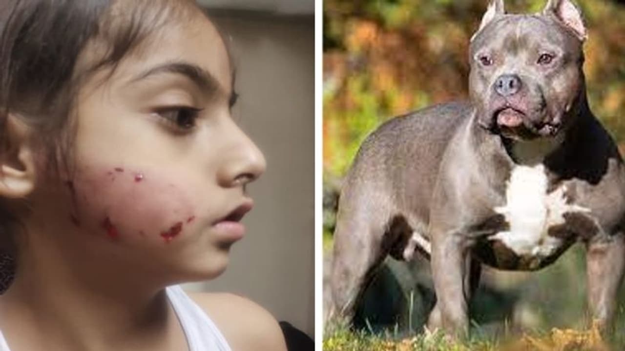 सावधान! पिटबुल डॉग ने देखिए 9 साल के मासूम का क्या हाल कर दिया, थाने पहुंचा मामला