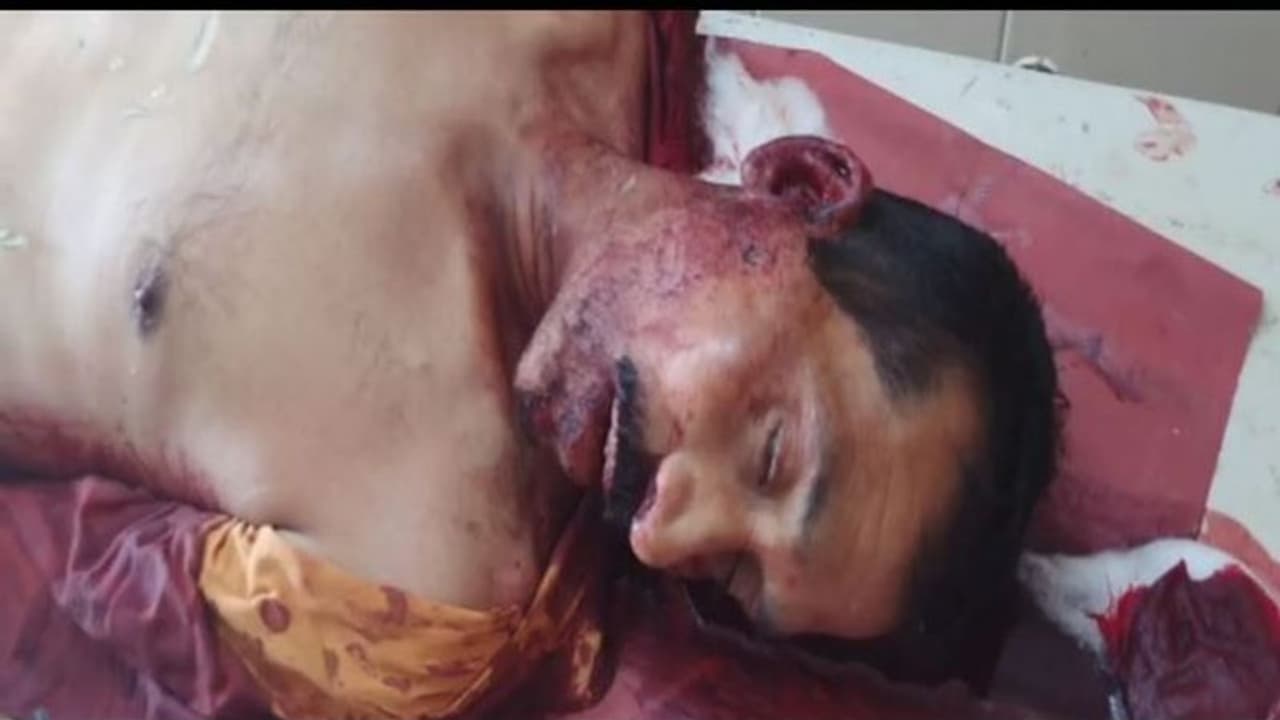 Telangana News: తెల్లవారితే కూతురు పెళ్లి... రోడ్డు ప్రమాదంలో తండ్రి దుర్మరణం Telangana News: తెల్లవారితే కూతురు పెళ్లి... రోడ్డు ప్రమాదంలో తండ్రి దుర్మరణం