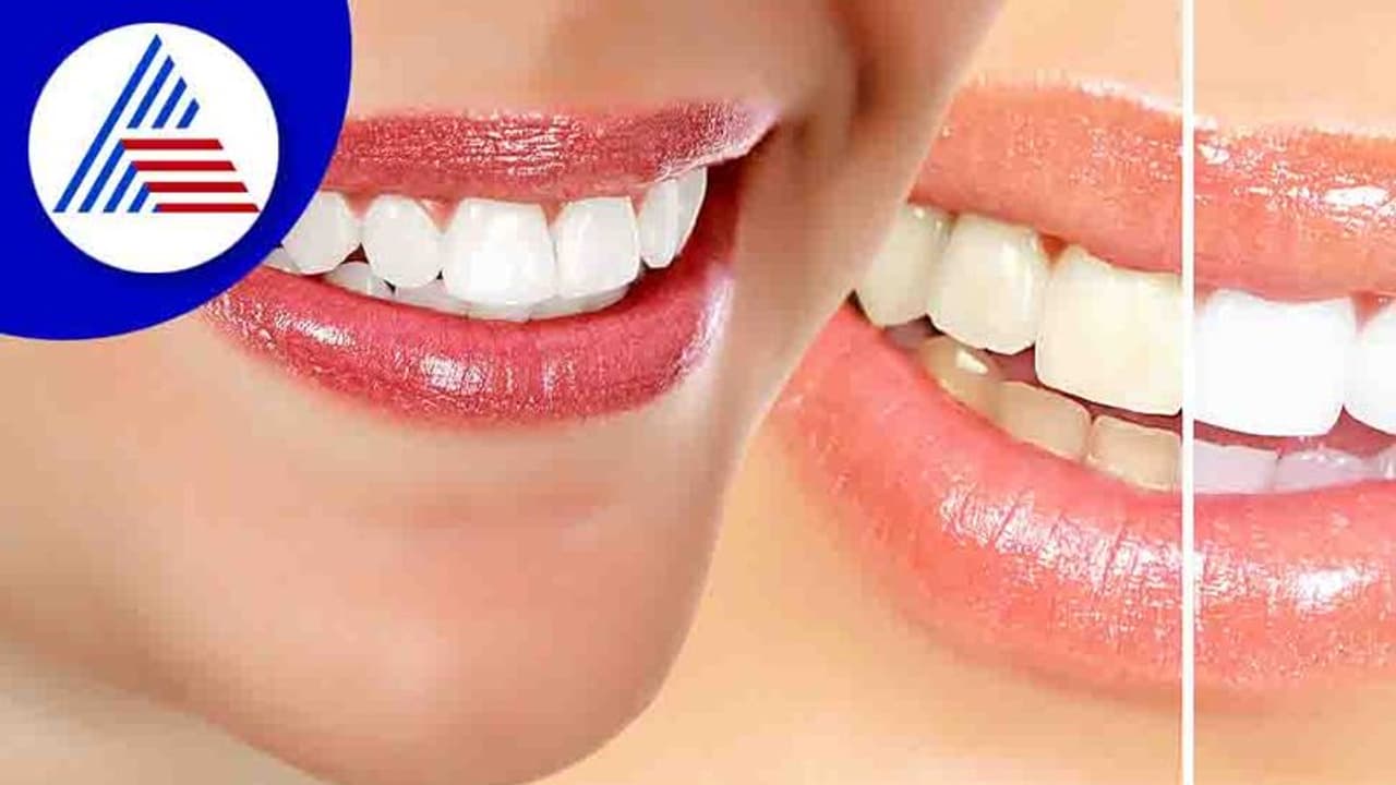 Tooth care: பல் அழகை பாதுகாக்கும் எளிய பாட்டி வைத்தியம் இதோ?