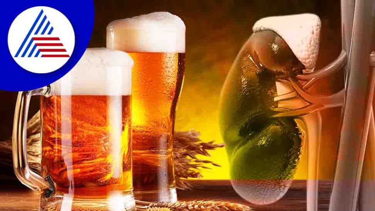 ಬಿಯರ್ ಕುಡಿಯೋದ್ರಿಂದ ಮೂತ್ರಪಿಂಡದ ಕಲ್ಲಿನ ಸಮಸ್ಯೆ ಕಡಿಮೆಯಾಗುತ್ತಾ ?