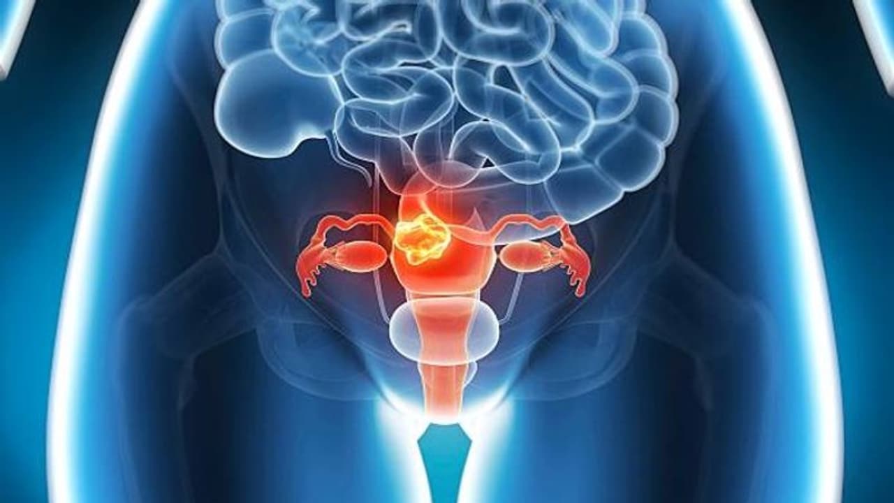 ছোট থেকেই অতিরিক্ত ওজনের শিকার? আশঙ্কা বাড়ছে গর্ভের ক্যান্সারের ছোট থেকেই অতিরিক্ত ওজনের শিকার? আশঙ্কা বাড়ছে গর্ভের ক্যান্সারের