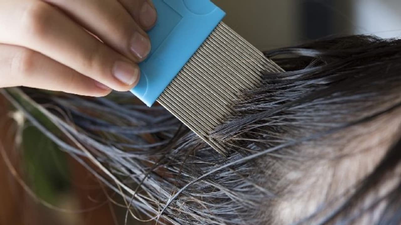 Lice Treatment : മുടിയിഴ കാണാന് പറ്റാത്തത് പോലെ പേനുകളുമായി ബാലിക; ചികിത്സയുടെ വീഡിയോ Lice Treatment : മുടിയിഴ കാണാന് പറ്റാത്തത് പോലെ പേനുകളുമായി ബാലിക; ചികിത്സയുടെ വീഡിയോ