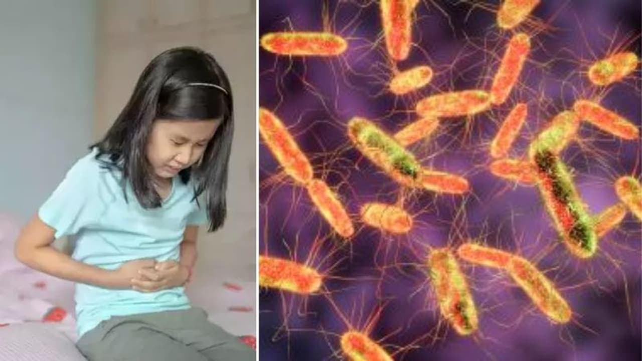 Salmonella outbreak : சாக்லெட் சாப்பிடுவதால் பரவும் சால்மோனெல்லா நோய்.. பெற்றோர்களே உஷார்.! WHO எச்சரிக்கை !! Salmonella outbreak : சாக்லெட் சாப்பிடுவதால் பரவும் சால்மோனெல்லா நோய்.. பெற்றோர்களே உஷார்.! WHO எச்சரிக்கை !!