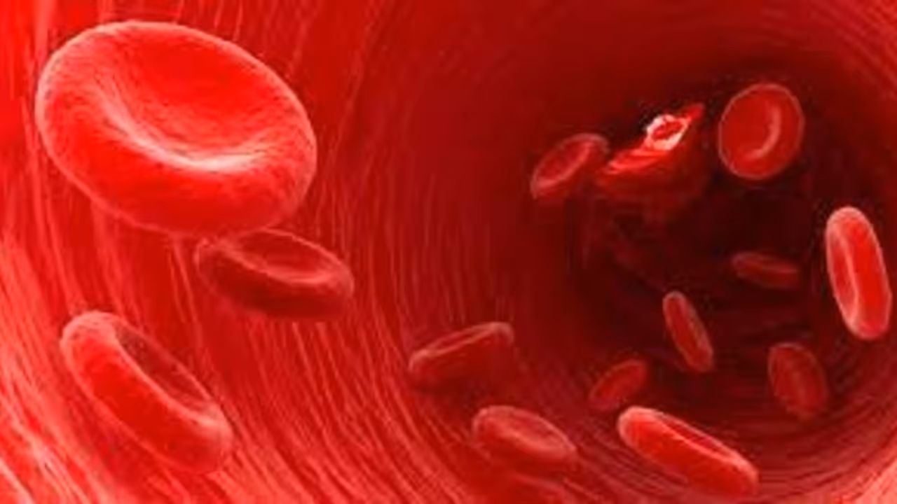 ഹീമോഗ്ലോബിന്റെ അളവ് കൂട്ടാം ; കഴിക്കാം ഈ ഭക്ഷണങ്ങൾ ഹീമോഗ്ലോബിന്റെ അളവ് കൂട്ടാം ; കഴിക്കാം ഈ ഭക്ഷണങ്ങൾ