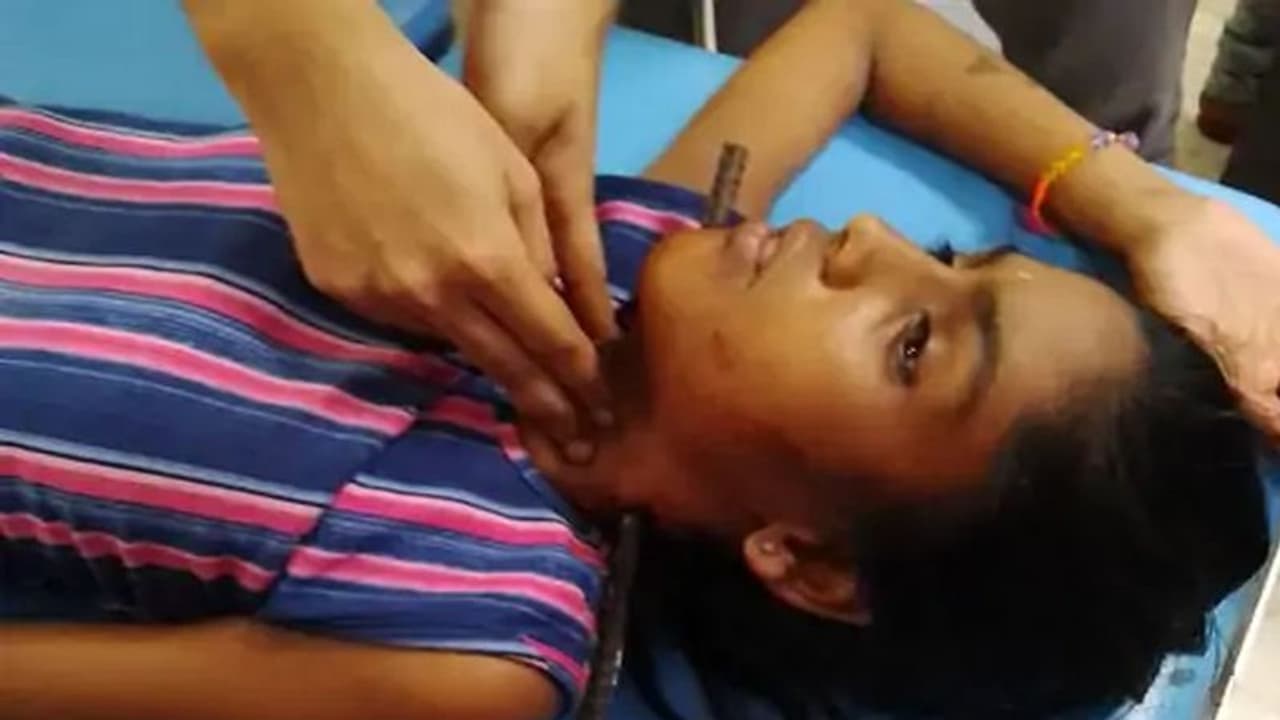 रायसेन में रूह कंपा देने वाला मामला : साइकिल चलाते वक्त छत से गिरी बच्ची, लोहे का सरिया गले के आर पार