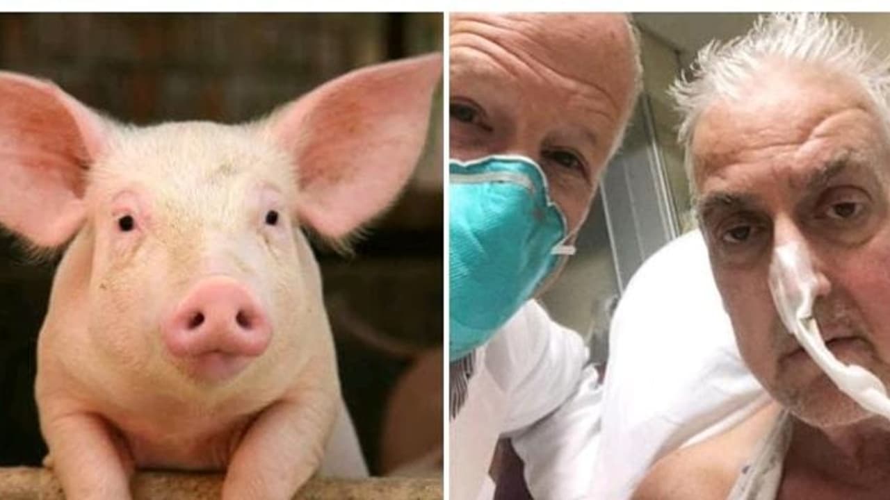 இதய நோயால் பாதிக்கப்படவருக்கு பன்றியின் இதயம்.! இதயத்தில் விலங்குகளுக்கான வைரஸ்..?அதிர்ச்சியில் மருத்துவர்கள்