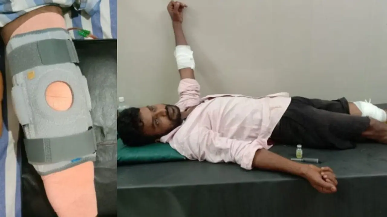 ಕಾಲಿನ ಗಾಯದಲ್ಲಿ 14 ಕಲ್ಲುಗಳು ಪತ್ತೆ, ಕ್ಲೀನ್ ಮಾಡದೇ ಹೊಲಿಗೆ ಹಾಕಿದ್ದ ಆಸ್ಪತ್ರೆ ಸಿಬ್ಬಂದಿ!