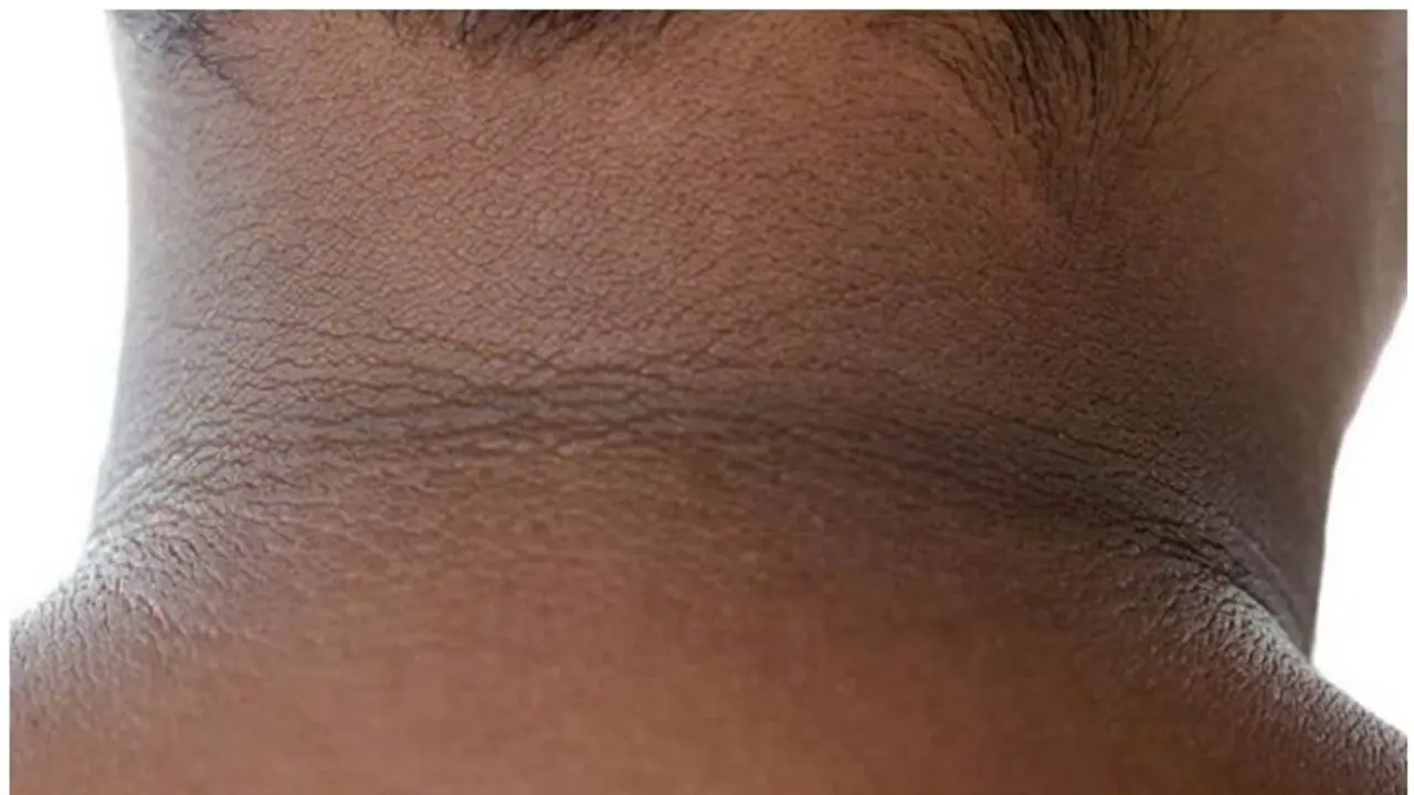 ঘাড়ের কালো পুরু দাগ তুলতে কাজে লাগান লবন, দ্রুত মিলবে উপকার ঘাড়ের কালো পুরু দাগ তুলতে কাজে লাগান লবন, দ্রুত মিলবে উপকার