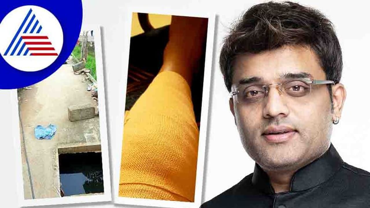 ಡ್ರೈನ್ ಹೋಲ್‌ಗೆ ಬಿದ್ದು ಕಾಲು ಮುರಿದುಕೊಂಡ ಗಾಯಕ ಅಜಯ್; ಬೇಜವಾಬ್ದಾರಿ ಅಧಿಕಾರಿಗಳ ವಿರುದ್ಧ ಅಸಮಾಧಾನ 