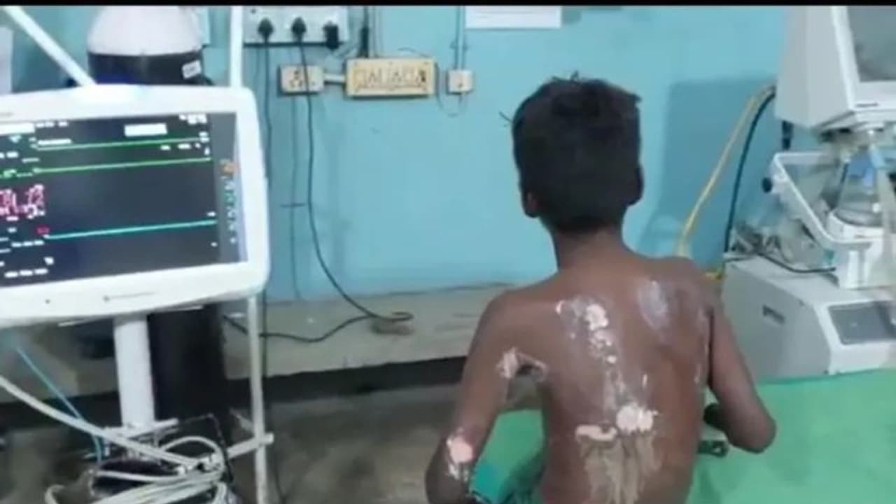 11 വയസ്സുകാരന് നേരെ ജാതി അതിക്ഷേപം, തീപ്പൊളളലേൽപ്പിച്ചു, മൂന്ന് പേർക്കെതിരെ കേസ് 11 വയസ്സുകാരന് നേരെ ജാതി അതിക്ഷേപം, തീപ്പൊളളലേൽപ്പിച്ചു, മൂന്ന് പേർക്കെതിരെ കേസ്