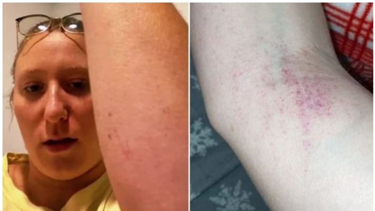 കയ്യിൽ ചെറിയ പുള്ളികൾ കാണാൻ തുടങ്ങി, ശരീരം മുഴുവനും വ്യാപിച്ചു, പരിശോധനയിൽ ബ്ലഡ് ക്യാൻസറാണെന്ന് സ്ഥിരീകരിച്ചു 