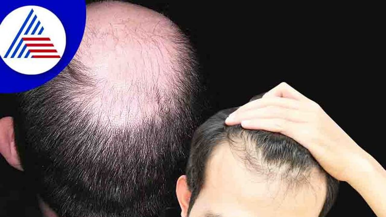 Hair Health : ಕೂದಲು ಉದುರಲು ಅತಿಯಾದ ಹಸ್ತಮೈಥುನವೂ ಒಂದು ಕಾರಣ