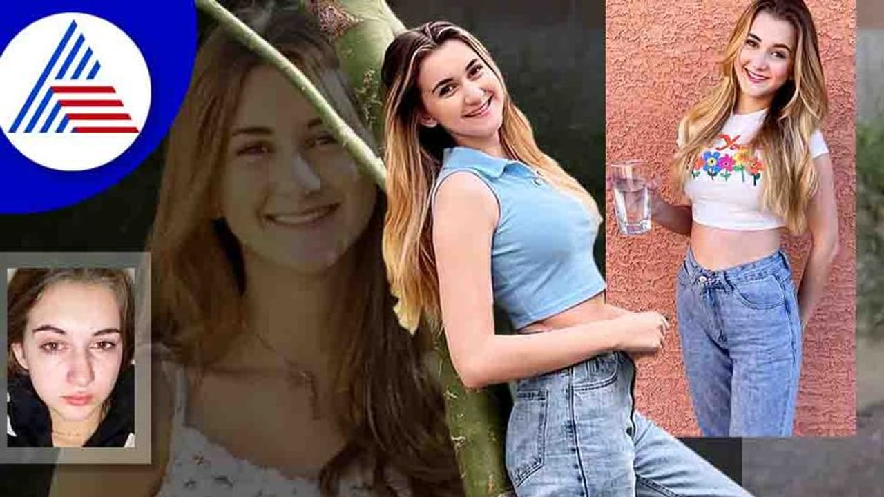 ಈಕೆಗೆ ನೀರೆಂದರೇ ಅಲರ್ಜಿ, ಕುಡಿದರೆ ವಾಂತಿಯಾಗುತ್ತೆ, ಕಣ್ಣೀರು ಹಾಕಿದರೆ ಆಸಿಡ್ ಸುರಿದಂತಾಗುತ್ತೆ ! ಈಕೆಗೆ ನೀರೆಂದರೇ ಅಲರ್ಜಿ, ಕುಡಿದರೆ ವಾಂತಿಯಾಗುತ್ತೆ, ಕಣ್ಣೀರು ಹಾಕಿದರೆ ಆಸಿಡ್ ಸುರಿದಂತಾಗುತ್ತೆ !