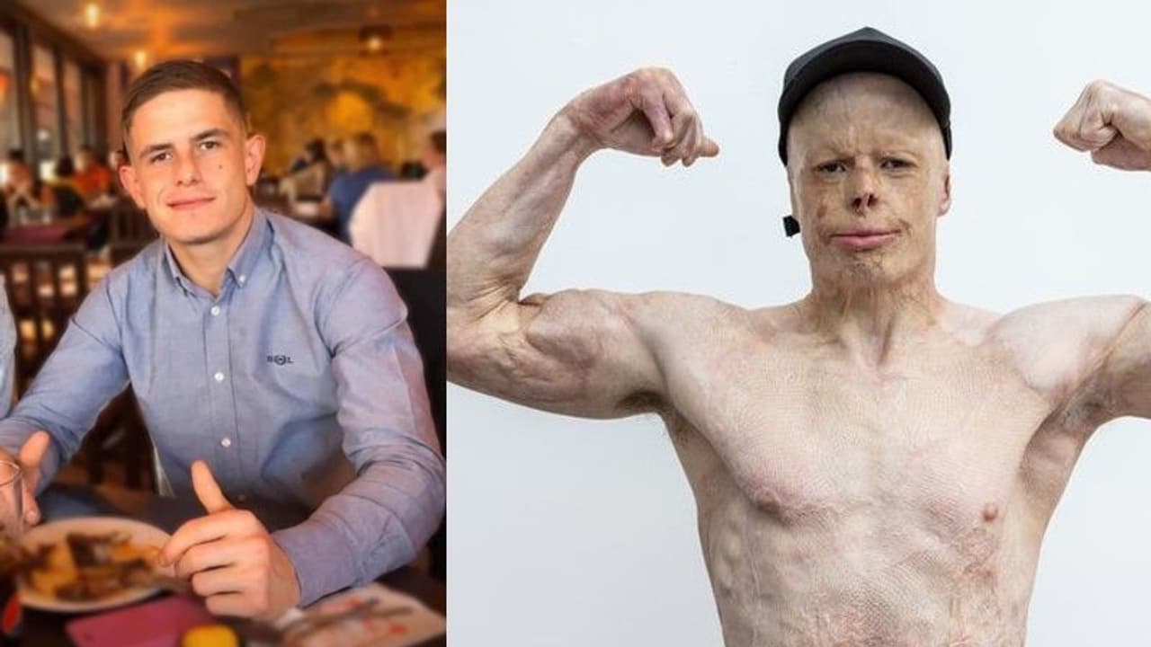 11000 വോള്ട്ട് ഷോക്കടിച്ച് അഗ്നിഗോളമായി മാറിയ ഒരാള് ; പിന്നീട് സംഭവിച്ചത് 11000 വോള്ട്ട് ഷോക്കടിച്ച് അഗ്നിഗോളമായി മാറിയ ഒരാള് ; പിന്നീട് സംഭവിച്ചത്