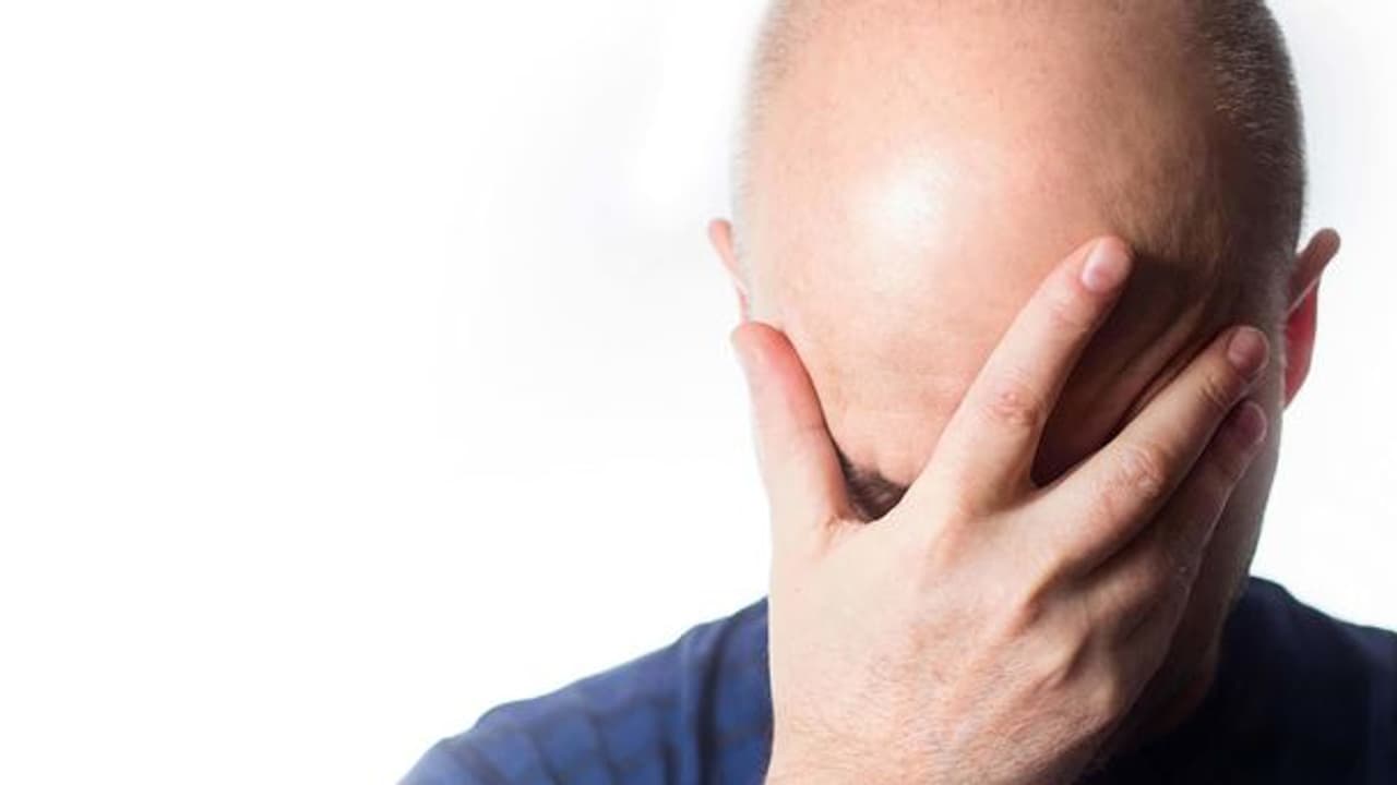 অল্প বয়সেই দেখা দিচ্ছে টাক পড়ার লক্ষণ? জেনে নিন কেন হয় এই সমস্যা, রইল সমাধানের পথ অল্প বয়সেই দেখা দিচ্ছে টাক পড়ার লক্ষণ? জেনে নিন কেন হয় এই সমস্যা, রইল সমাধানের পথ