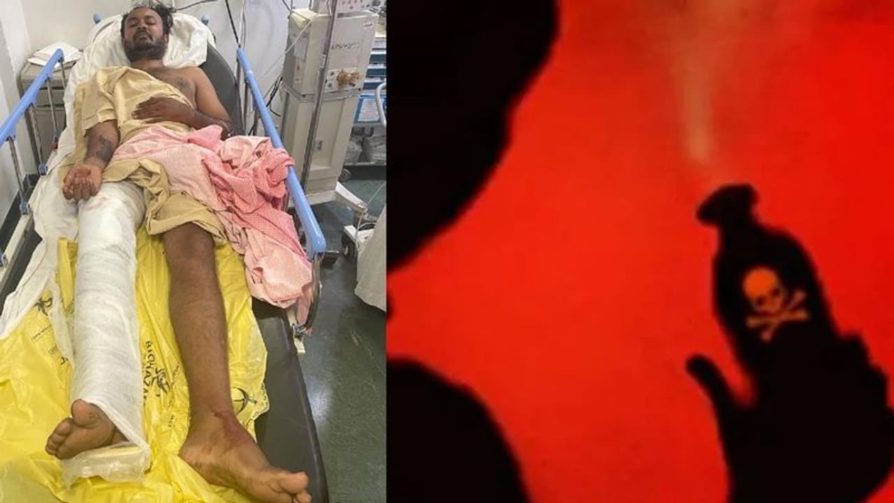 ಆಸಿಡ್ ದಾಳಿ ಪ್ರಕರಣ: ಎಸ್ಕೇಪ್ ಆಗ ಹೊರಟ ಆರೋಪಿ ನಾಗೇಶ್ ಕಾಲಿಗೆ ಗುಂಡೇಟು!