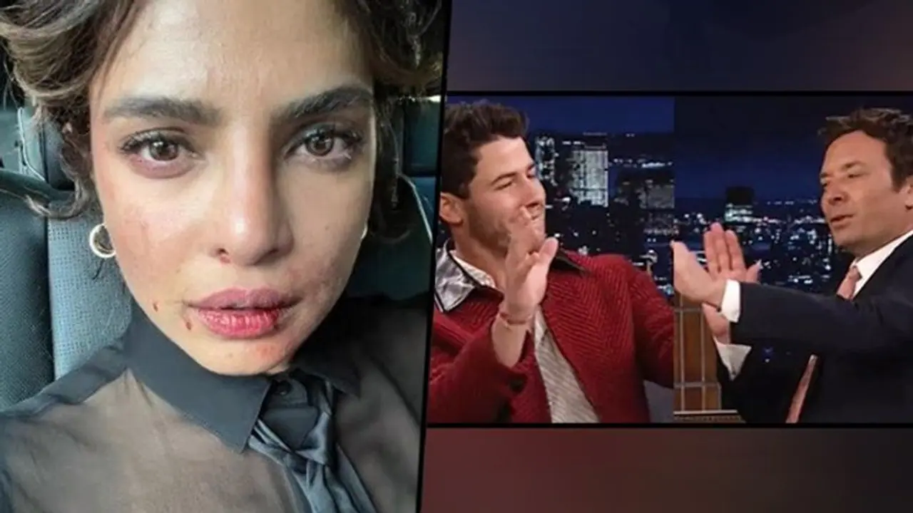 Priyanka Chopra's face covered in bruises; Nick Jonas showed Bollywood dance to Jimmy Fallon (Video)