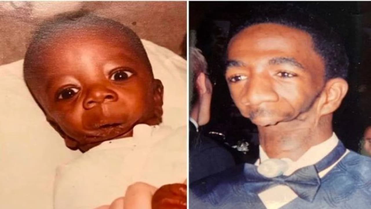 'मैं पैदा हुआ तो मां मुझे देखकर डर गई, अनाथ छोड़कर चली गई, आज भी डरते हैं और दूर भागते हैं लोग' 'मैं पैदा हुआ तो मां मुझे देखकर डर गई, अनाथ छोड़कर चली गई, आज भी डरते हैं और दूर भागते हैं लोग'