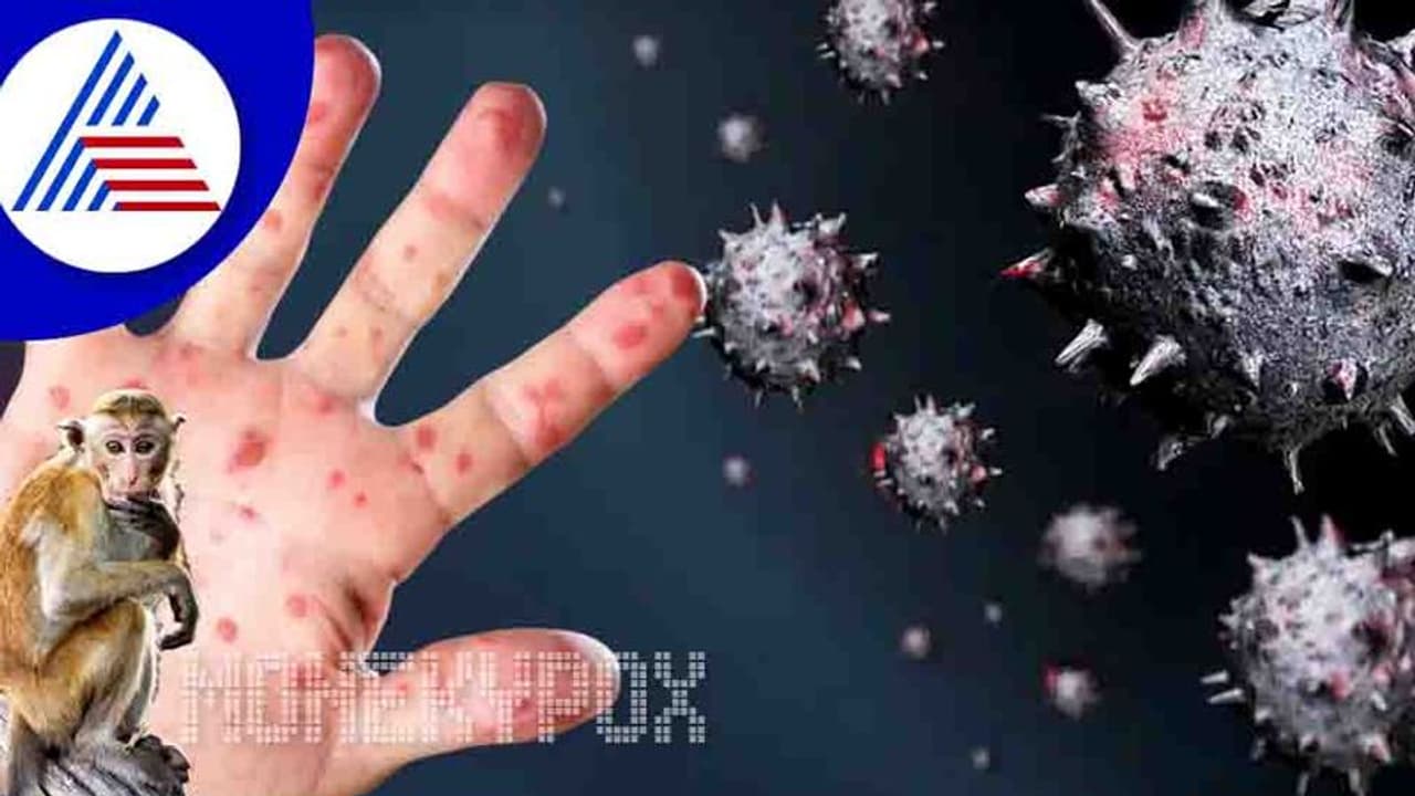 Monkeypox Virus ಮಂಕಿಪಾಕ್ಸ್‌ ಬಗ್ಗೆ ಕೇಂದ್ರ ಕಟ್ಟೆಚ್ಚರ, 1 ಕೇಸಿದ್ದರೂ ಸ್ಫೋಟವೆಂದು ಪರಿಗಣನೆ!