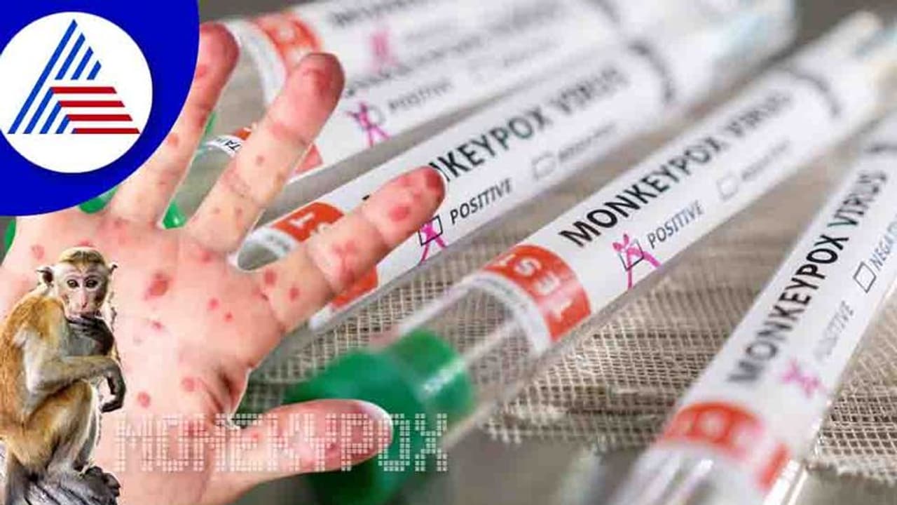 ಅಮೆರಿಕದಲ್ಲಿ ಮಂಕಿಪಾಕ್ಸ್ ಆತಂಕ, ತುರ್ತು ಆರೋಗ್ಯ ಪರಿಸ್ಥಿತಿ ಘೋಷಿಸಿದ ಸ್ಯಾನ್ ಫ್ರಾನ್ಸಿಸ್ಕೋ!