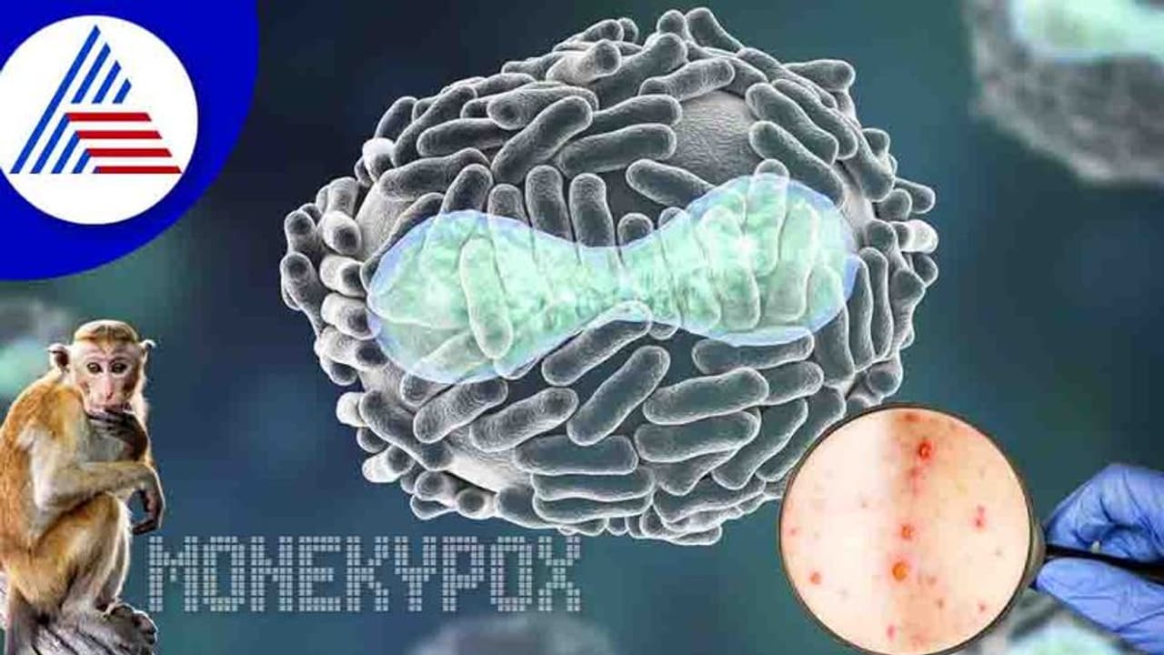 ಕೋವಿಡ್ ಭೀತಿ ನಡುವೆ ಮಂಕಿಪಾಕ್ಸ್ ಪ್ರಕರಣ ಏರಿಕೆ, ದೆಹಲಿಯಲ್ಲಿ ಮತ್ತೊಂದು ಕೇಸ್ ಪತ್ತೆ!