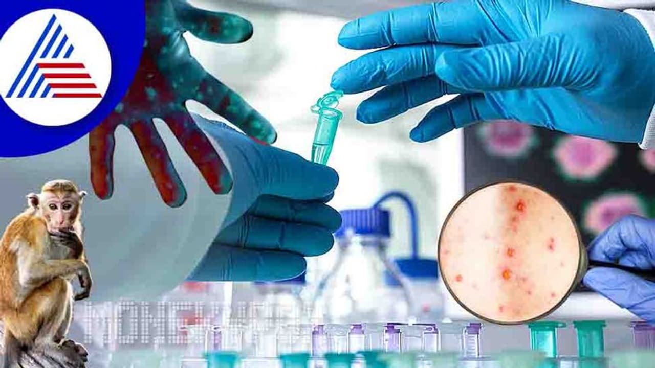 ಭಾರತದಲ್ಲಿ 3ನೇ ಮಂಕಿಪಾಕ್ಸ್ ಪ್ರಕರಣ ದೃಢ, ಕೇರಳದಲ್ಲಿ ಹೈ ಅಲರ್ಟ್!