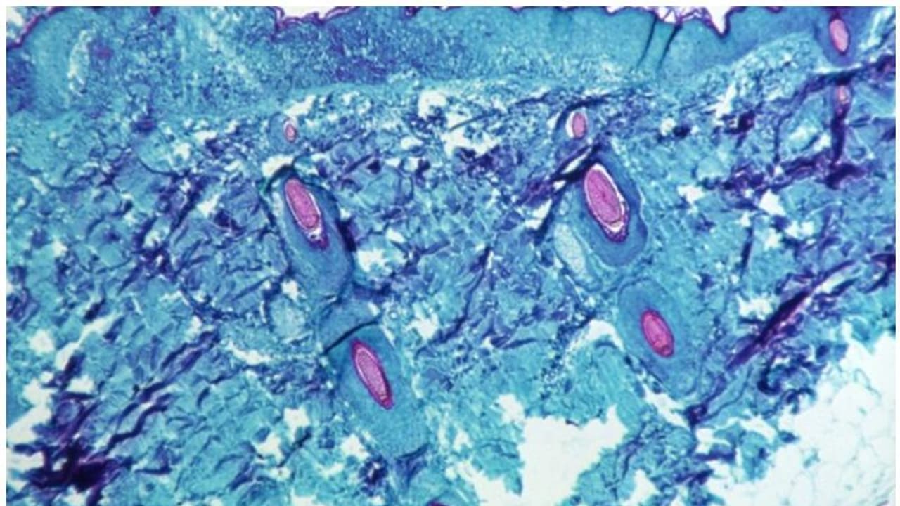കുരങ്ങുപനി; യുഎഇയില് നാല് പുതിയ കേസുകള് കൂടി സ്ഥിരീകരിച്ചു കുരങ്ങുപനി; യുഎഇയില് നാല് പുതിയ കേസുകള് കൂടി സ്ഥിരീകരിച്ചു