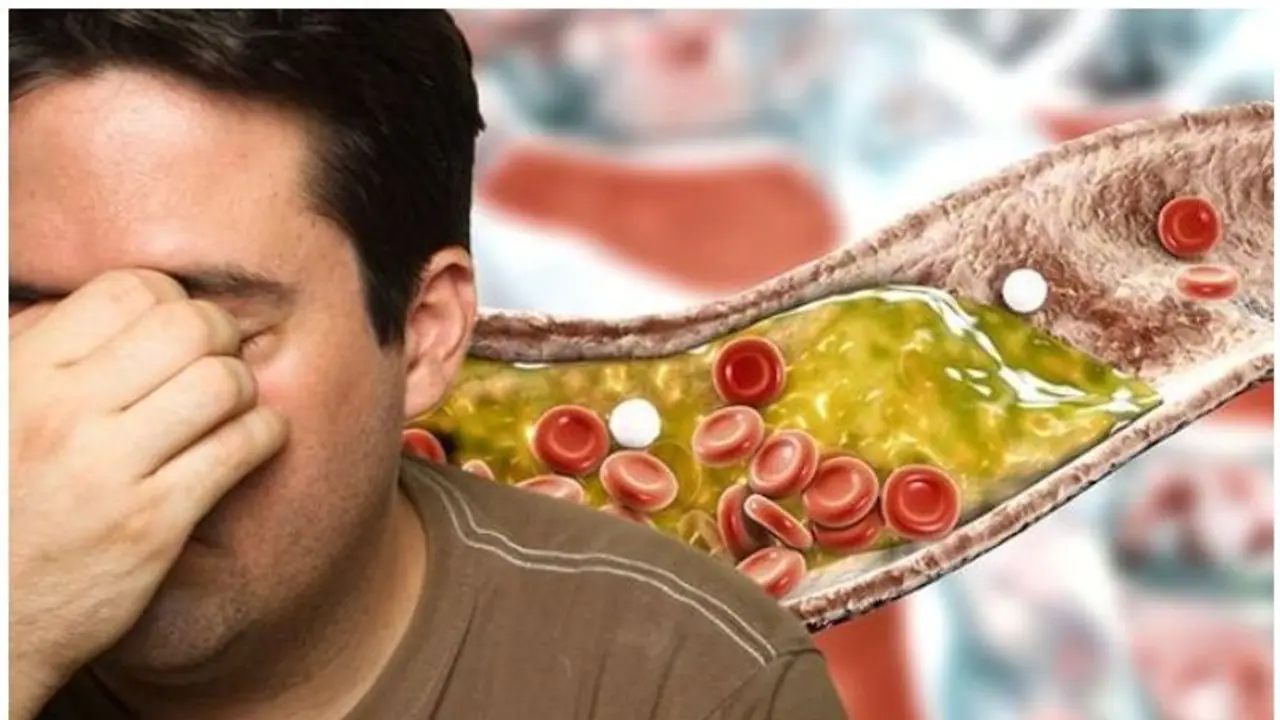 High Cholesterol : ഉയർന്ന കൊളസ്ട്രോൾ കുറയ്ക്കാൻ ജീവിതശെെലിയിൽ വരുത്തേണ്ട ചില മാറ്റങ്ങൾ