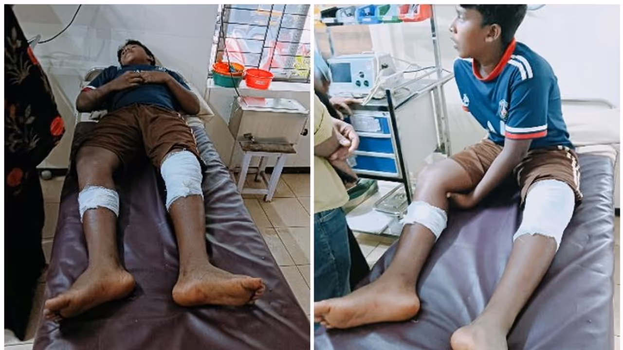 തിരുവമ്പാടിയിൽ കാട്ടുപന്നിയുടെ ആക്രമണം; പന്ത്രണ്ടുകാരനെ കുത്തിവീഴ്ത്തി, പന്നിയെ വെടിവെച്ച് കൊന്നു തിരുവമ്പാടിയിൽ കാട്ടുപന്നിയുടെ ആക്രമണം; പന്ത്രണ്ടുകാരനെ കുത്തിവീഴ്ത്തി, പന്നിയെ വെടിവെച്ച് കൊന്നു