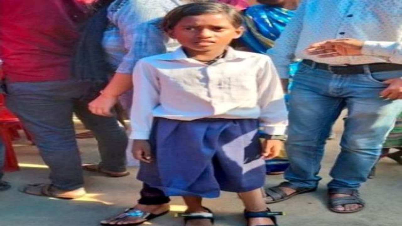 अब एक पैर पर कूदते हुए नहीं बल्कि, दोनों पैरों से चलकर स्कूल जाएगी सीमा, 2 साल पहले हादसे में कटा था बायां पैर