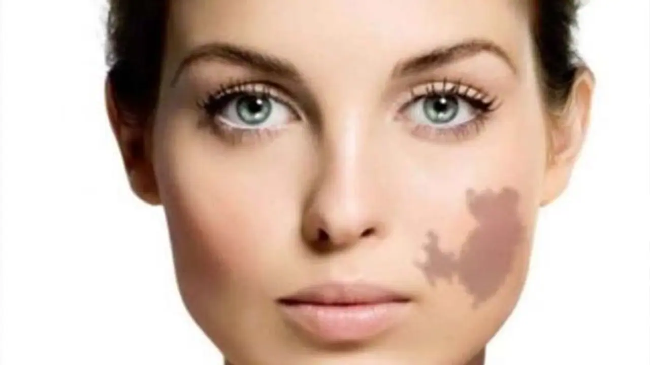 শরীরে এমন দাগ থাকা মানুষদের ভাগ্যবান মনে করা হয়, জেনে নিন কি বলছে সমুদ্র শাস্ত্র শরীরে এমন দাগ থাকা মানুষদের ভাগ্যবান মনে করা হয়, জেনে নিন কি বলছে সমুদ্র শাস্ত্র