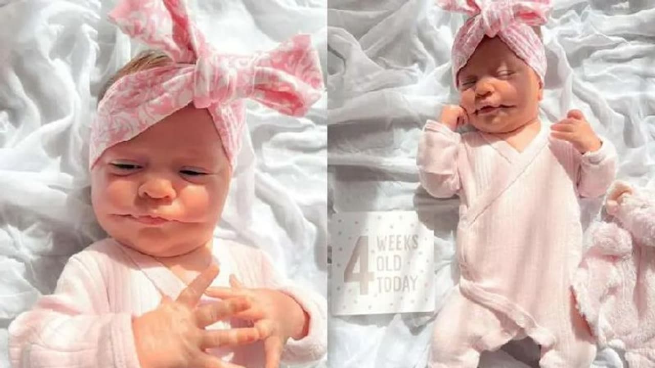 Permanent Smile : എപ്പോഴും പുഞ്ചിരിക്കുന്ന കുഞ്ഞ്; ഇത് അപൂര്‍വമായ രോഗാവസ്ഥ