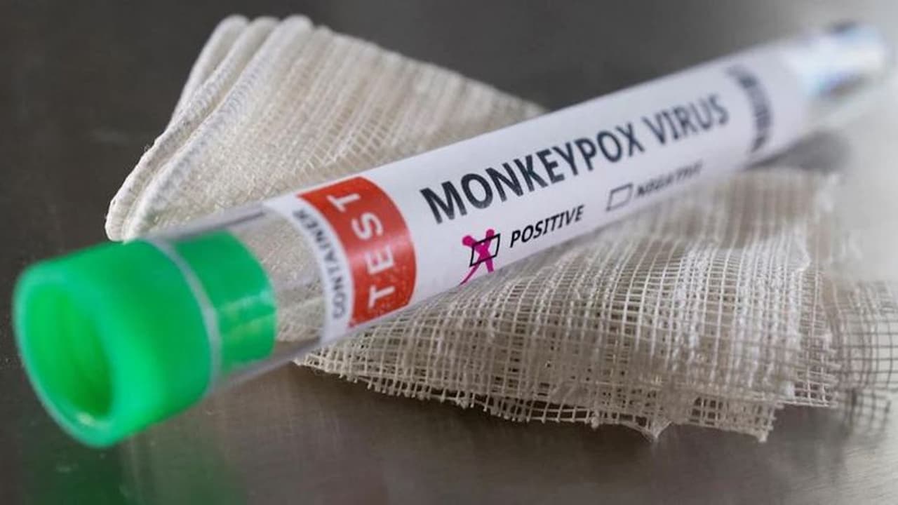 4th Monkeypox Case in India: ವಿದೇಶಕ್ಕೇ ಹೋಗದ ವ್ಯಕ್ತಿಗೆ ಬಂತು ಮಂಕಿಪಾಕ್ಸ್‌..! 