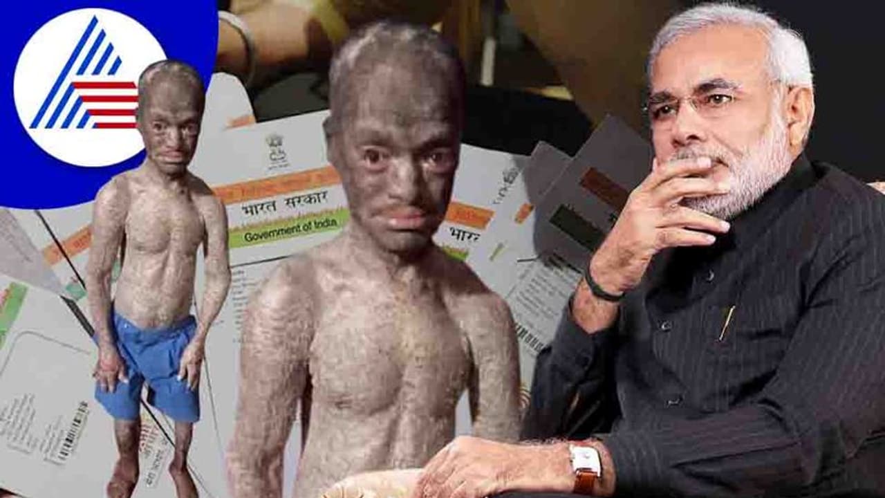 ಅಂಗವಿಕಲನಿಗೆ ಆಧಾರ್ ಕಾರ್ಡ್ ಕೊಡಿಸಿದ ಪ್ರಧಾನಿ ಮೋದಿ: 2 ವರ್ಷದ ಸಮಸ್ಯೆಗೆ ಎರಡೇ ದಿನದಲ್ಲಿ ಪರಿಹಾರ..! ಅಂಗವಿಕಲನಿಗೆ ಆಧಾರ್ ಕಾರ್ಡ್ ಕೊಡಿಸಿದ ಪ್ರಧಾನಿ ಮೋದಿ: 2 ವರ್ಷದ ಸಮಸ್ಯೆಗೆ ಎರಡೇ ದಿನದಲ್ಲಿ ಪರಿಹಾರ..!